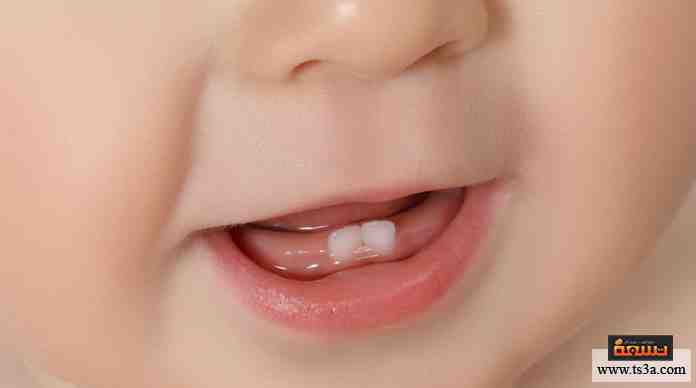 تساقط الأسنان كيف يمكن علاج مشكلة هشاشة أسنان الأطفال تسعة